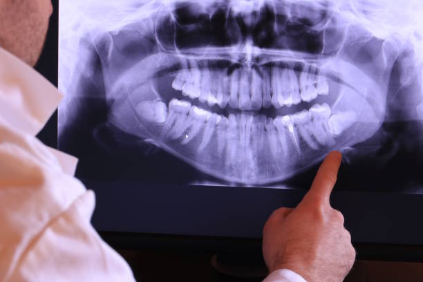 Best 24-Hour Emergency Dental Care in Chouteau, OK