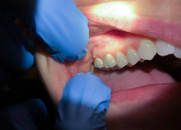 Best 24-Hour Emergency Dental Care in Chouteau, OK