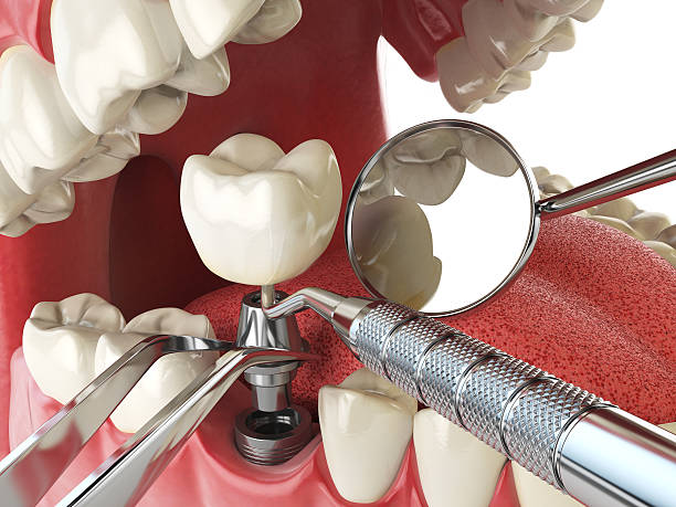 Best Emergency Root Canal Therapy in Chouteau, OK